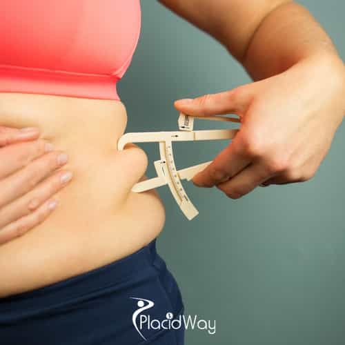 5 Reasons Canadian Post-Bariatric Patients are Choosing Cancun for a Belt Lipectomy